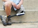 Výskum doktorandky Univerzity Komenského môže pomôcť pri liečbe kritickej končatinovej ischémie